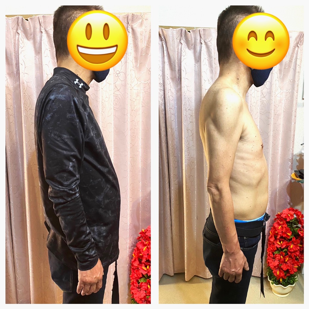Before/After